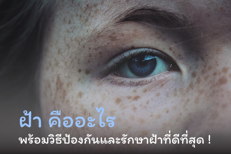 ฝ้า