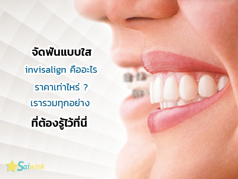 จัด ฟัน invisalign ราคา