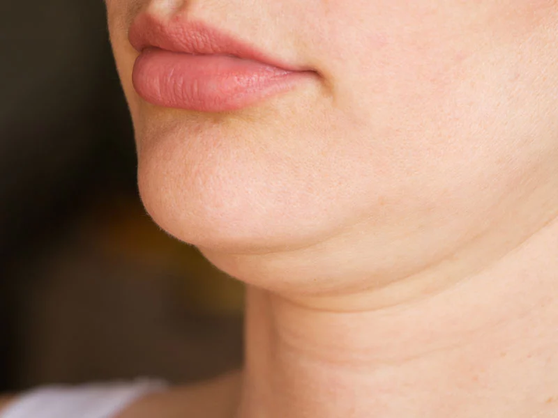 ร้อยไหมเหนียง