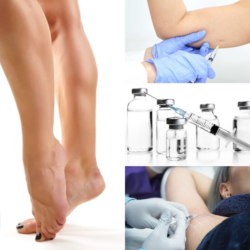 โบท็อกเฉพาะจุด