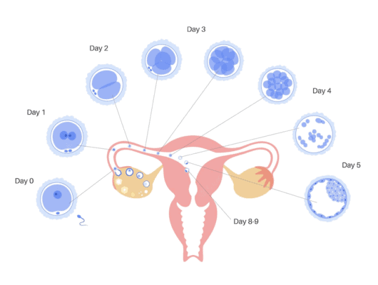 ขั้นตอนการทำ IUI