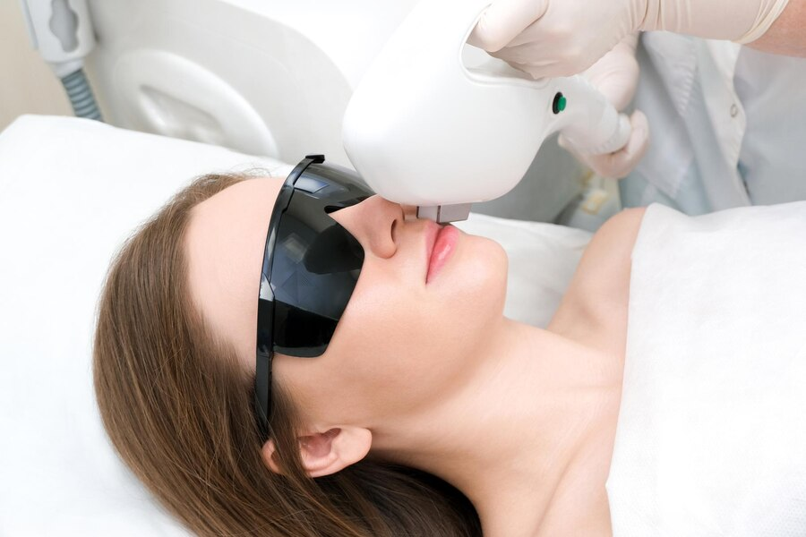 เลเซอร์สิว