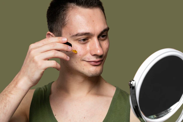 การรักษาสิวสเตียรอยด์