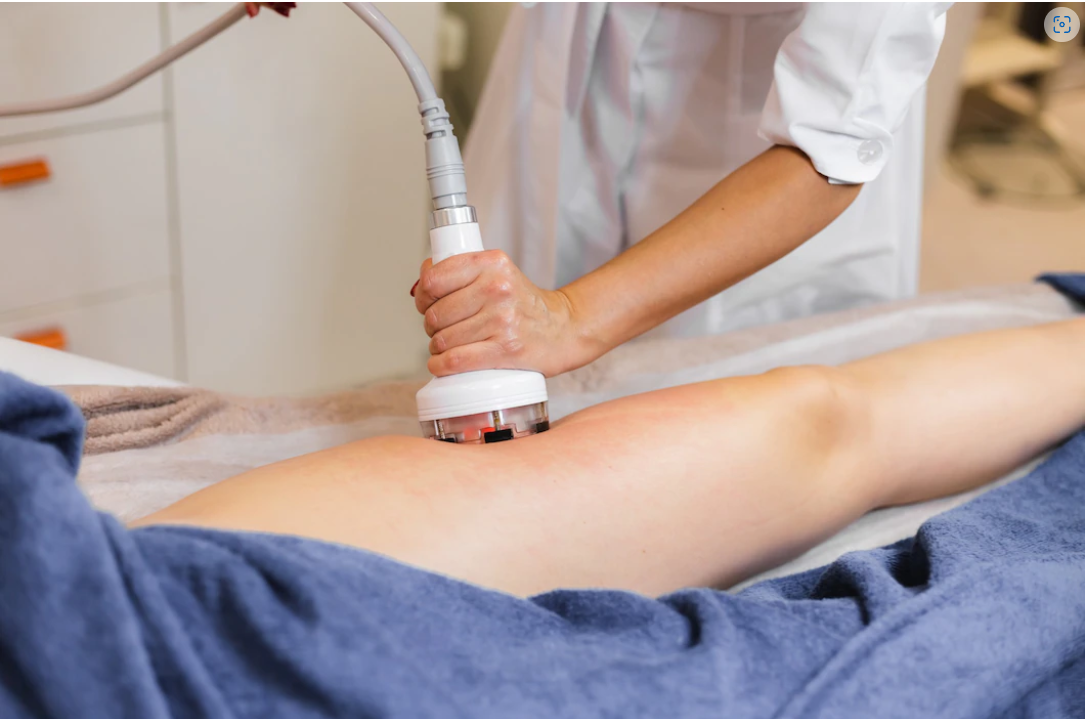 กําจัดขนหน้าแข้งถาวร