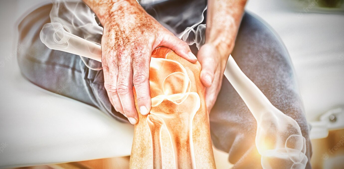 ข้อเข่าเสื่อม